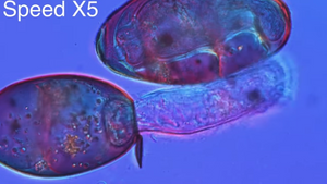 Incredible video shows all the stages of the liver fluke lifecycle