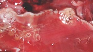 Lungworm in a lung