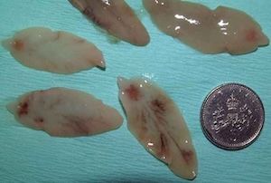 Adult liver fluke can be larger than a 5 pence piece